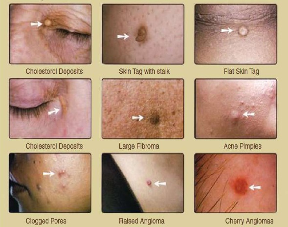 conditions to treat with skin system